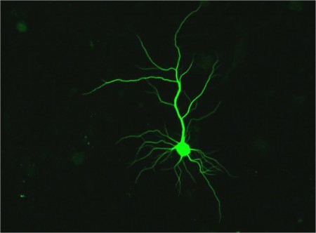 MAP2+ pyramidal neuron in vitro